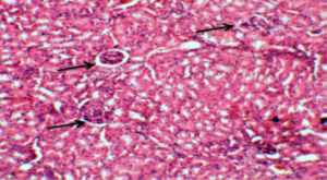 Figure 11: Photograph of a kidney section from treated group with Herbal extract showing pathological improvement with normal appearance of the glomeruli (→)