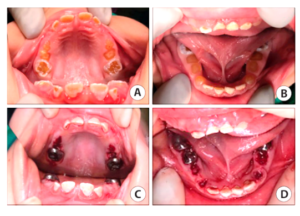 Figure 4: Clinic images for Case 2