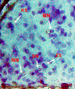 Figure 4.6: Micronucleus test and nuclear alterations, Binucleated nuclei (BN), segmented nuclei (SN) Notched shaped (NN), Kidney shaped nuclei (KN) and 8 shaped nuclei (EN) observed in the blood of freshwater fish injected with di-methyl-phthalate
