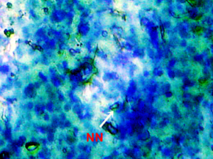 Figure 4.2:  Micronucleus test and nuclear alterations, Notched nuclei (NN) observed in the blood of freshwater fish injected with di-methyl-phthalate