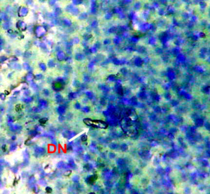 Figure 4.3 Micronucleus test and nuclear alterations, Dumbelled shaped nuclei (DN) observed in the blood of freshwater fish injected with di-methyl-phthalate