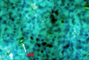 Figure 4.4 Micronucleus test and nuclear alterations, Notched nuclei (NN) observed in the blood of freshwater fish injected with di-methyl-phthalate