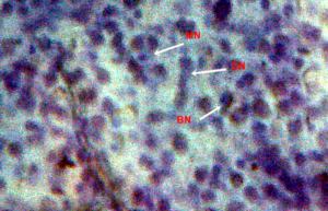 Figure 4.5 Micronucleus test and nuclear alterations, Binucleated nuclei (BN), segmented nuclei (SN) and Micronuclei (MN) observed in the blood of freshwater fish injected with di-methyl-phthalate