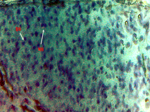Figure 4.7: Micronucleus test and nuclear alterations, Notched nuclei (NN) and Binucleated nuclei (BN) observed in the blood of freshwater fish injected with di-methyl-phthalate