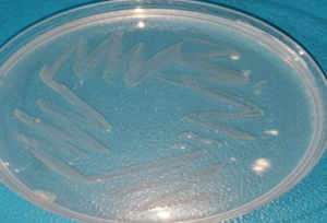 Figure 7a: White colonyshowing the growth of E.coli from salivary gland of ticks on endo agar