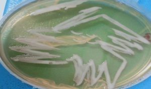 Figure 8a: Creamy white colony showing the growth of Enterobacter and E.coli from salivary gland on sheep blood agar
