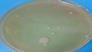 Figure 8d: White colony showing the growth of E.coli from midgut on sheep blood agar