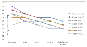 Changes in driving pressure in consecutive prone sessions